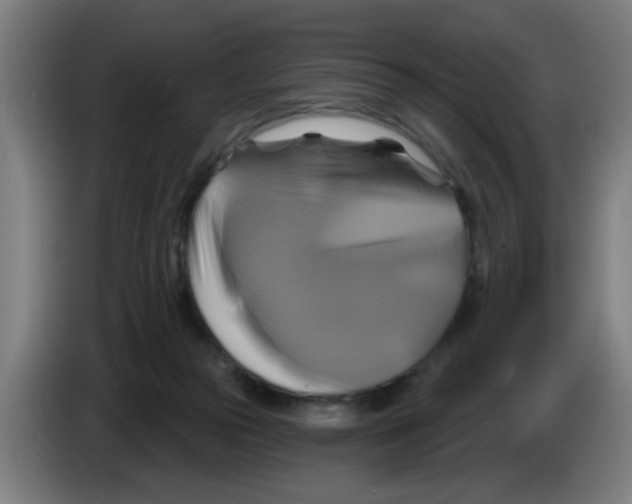 X0000086220169200704261843