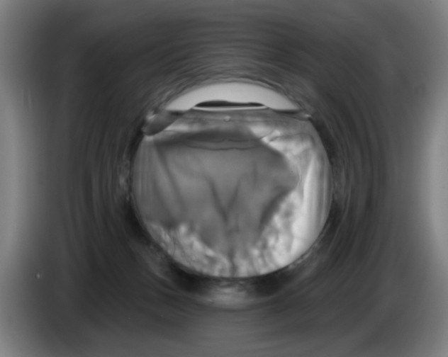 X0000086220175200704261843