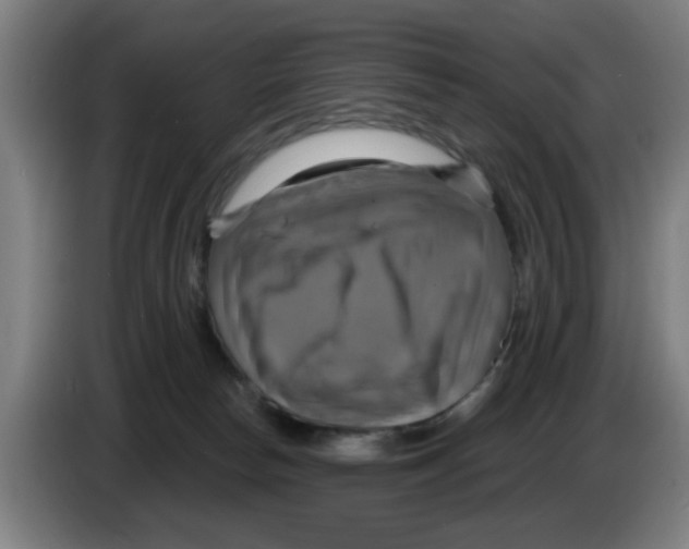 X0000086220178200704261843