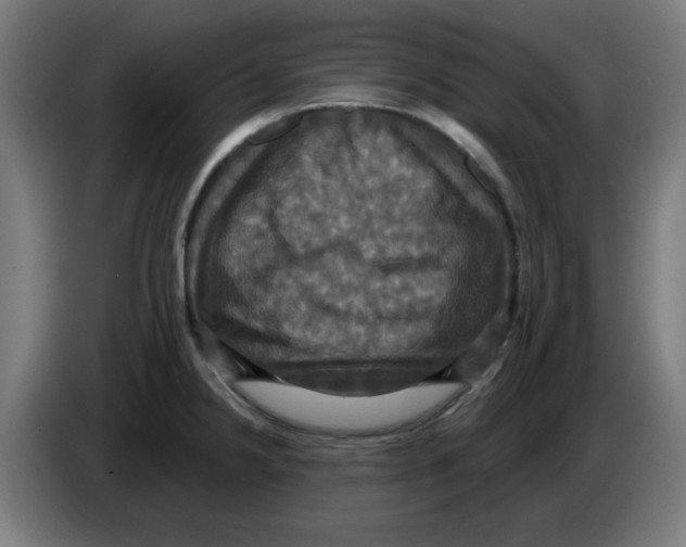 X0000086221238200704261830