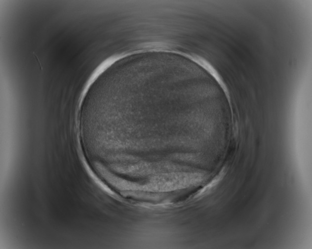 X0000086231389200704191750