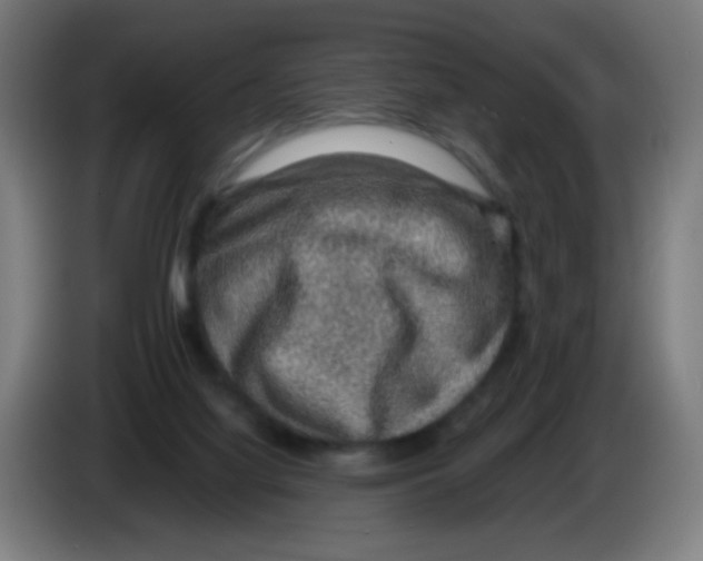 X0000086230068200704261904