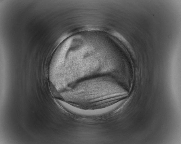 X0000086231185200704261850