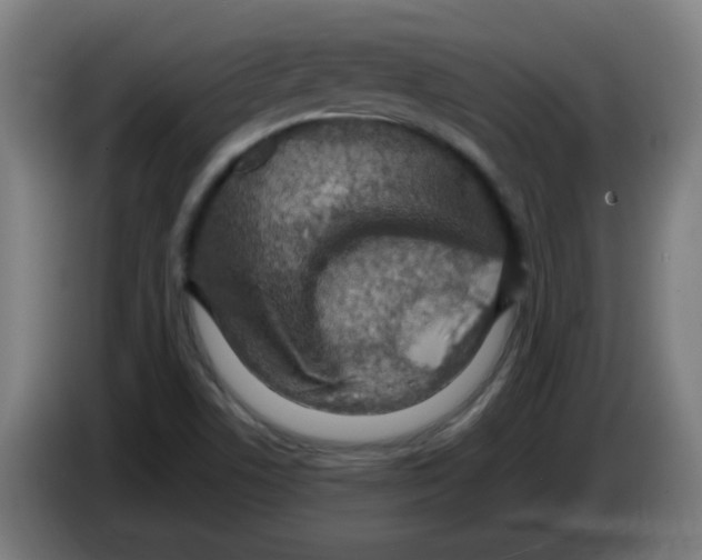 X0000086231506200704261846