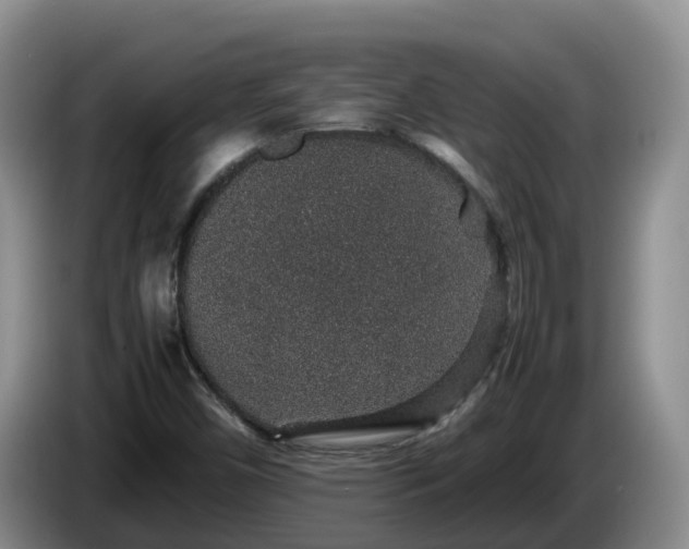 X0000086241450200704051208