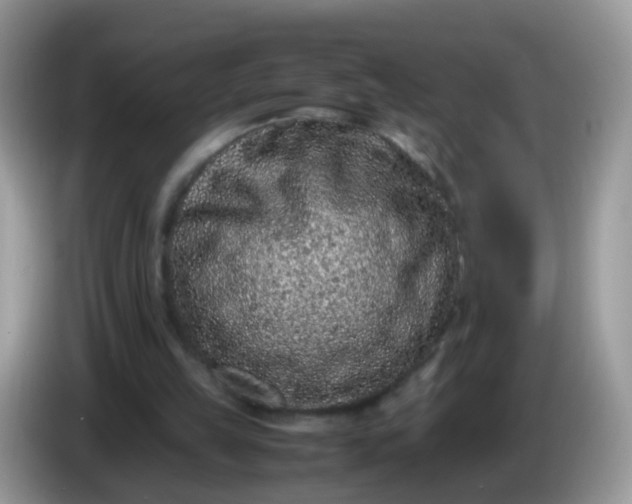 X0000086240149200704121940