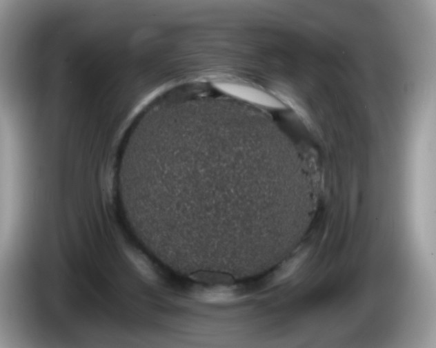X0000086240156200704121940