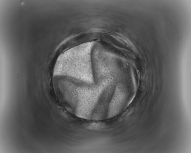 X0000086241160200704121928