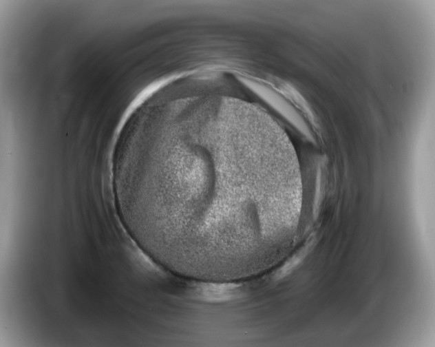X0000086241184200704121928