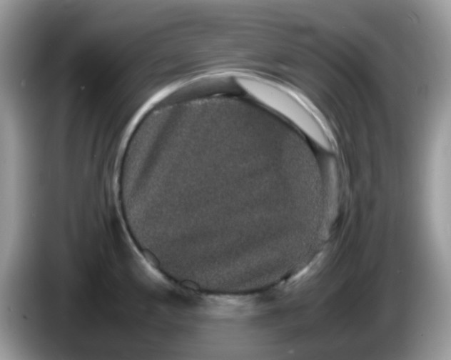 X0000086241197200704121928