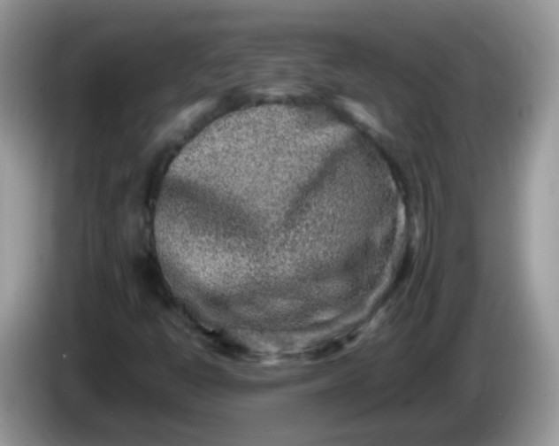 X0000086241398200704121925