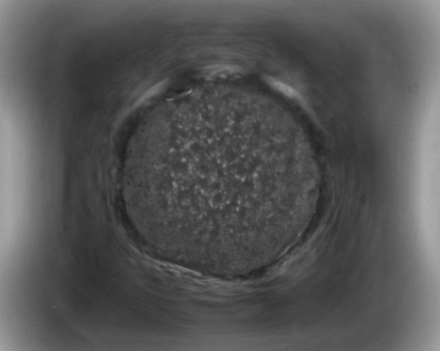 X0000086241399200704121925