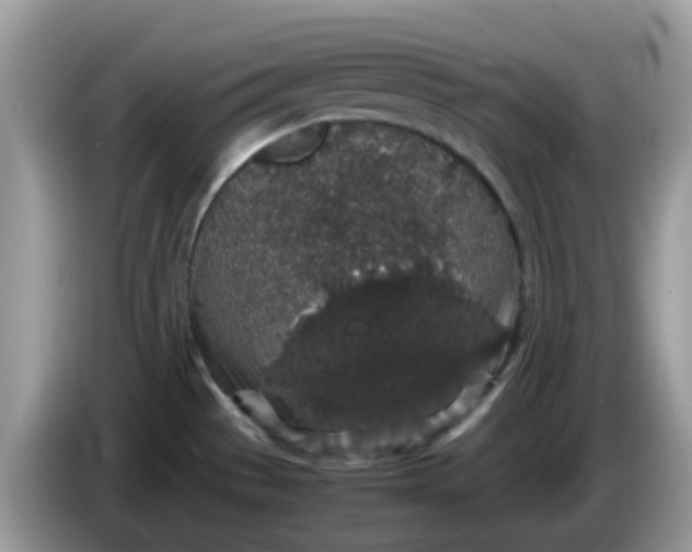 X0000086241529200704121924
