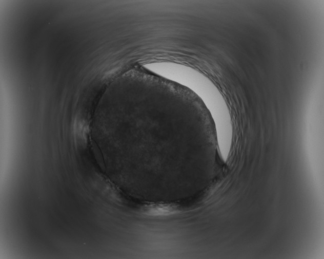 X0000086240235200704191827