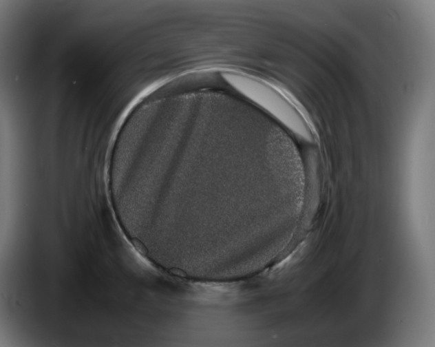 X0000086241197200704191814