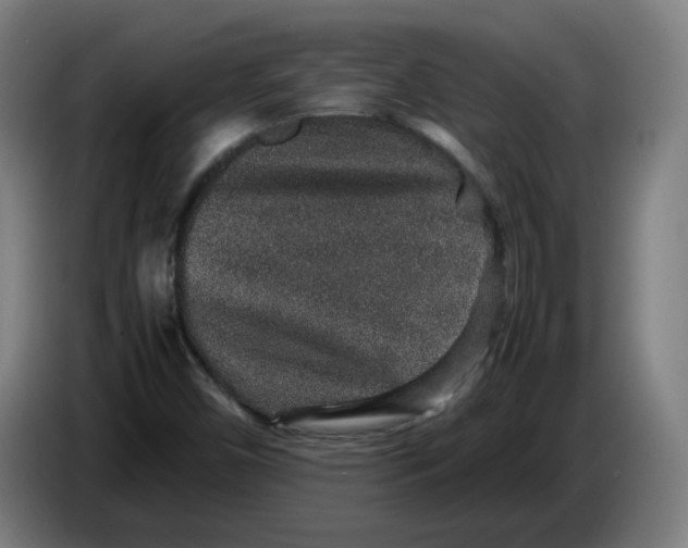 X0000086241450200704191811