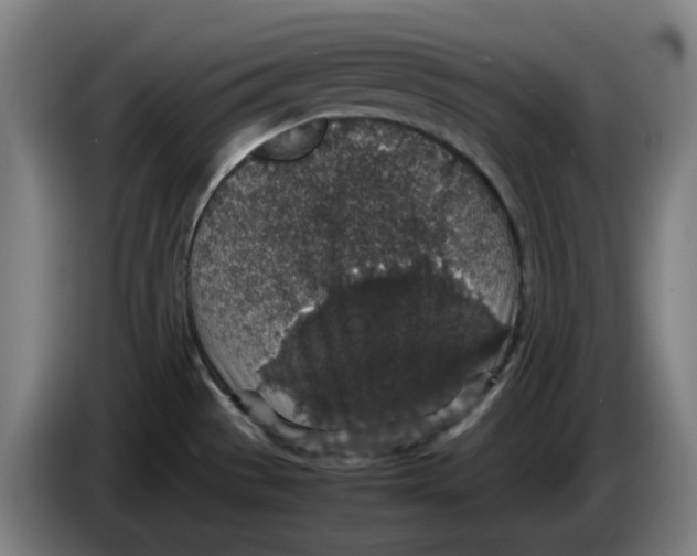 X0000086241529200704191810