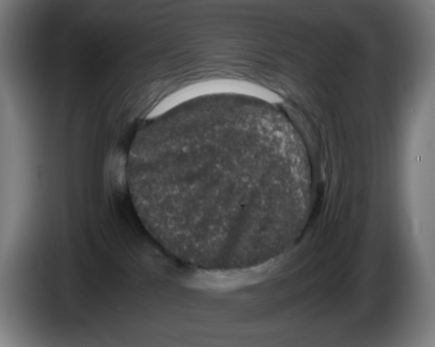 X0000086240041200704261925
