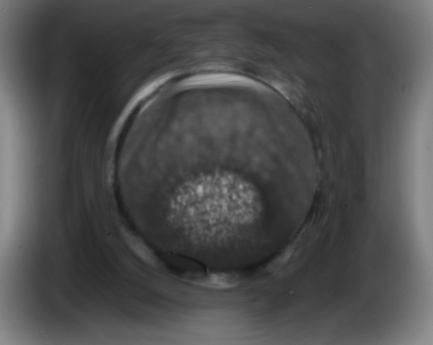 X0000086240056200704261924