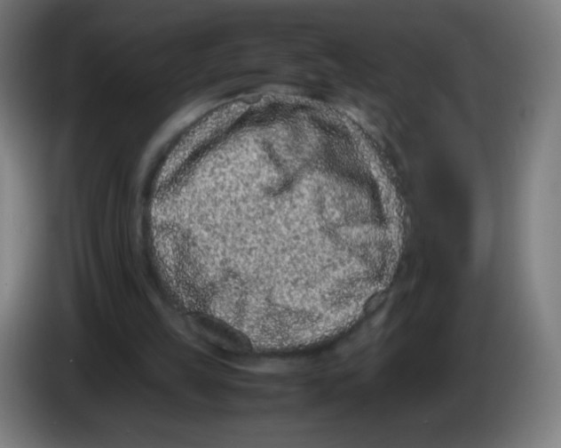 X0000086240149200704261923