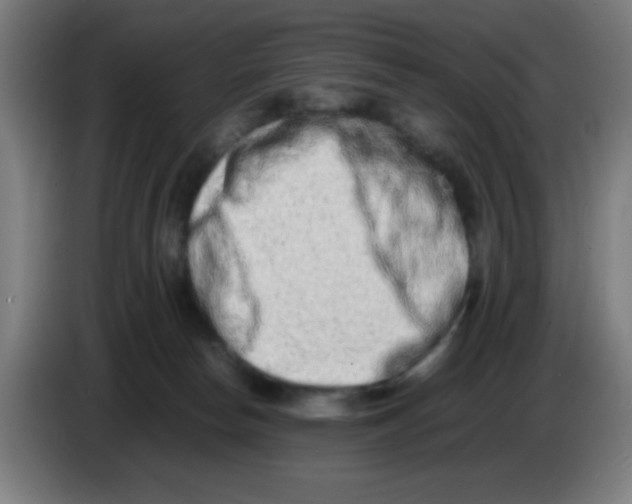 X0000086240178200704261923
