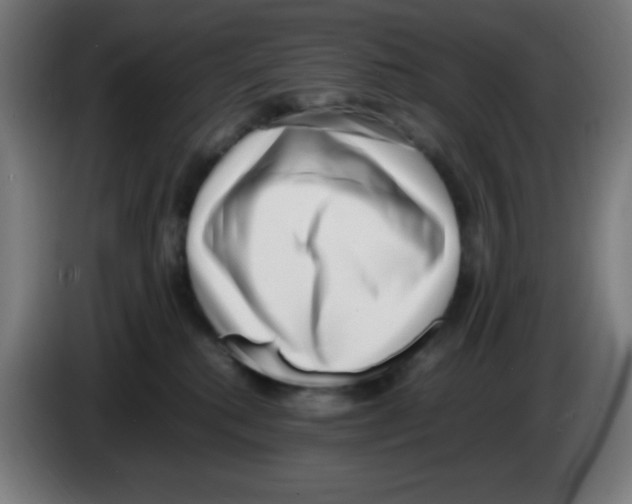 X0000086240280200704261922