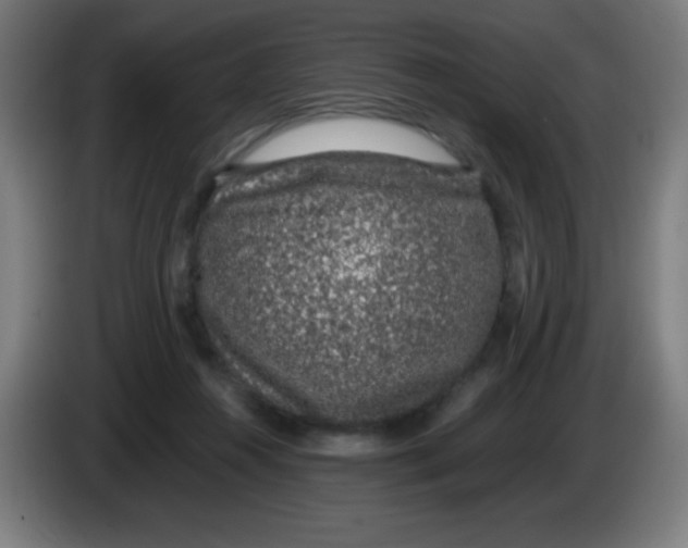 X0000086240360200704261920