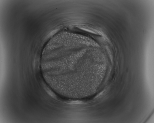 X0000086240397200704261920