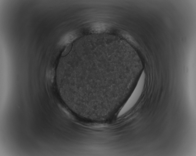 X0000086240458200704261919