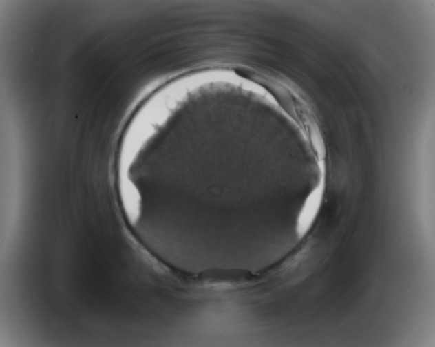X0000086240958200704261913