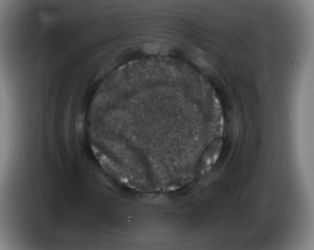 X0000086241154200704261910