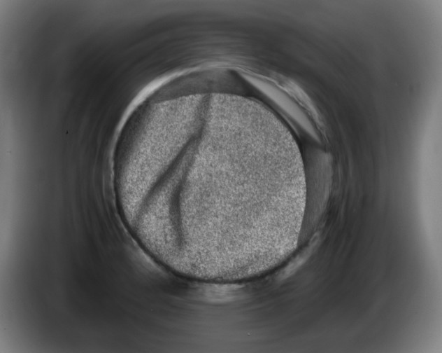 X0000086241184200704261910