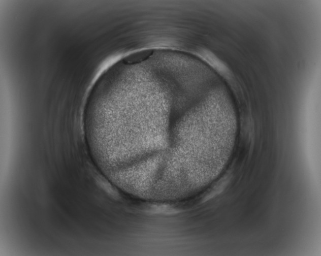 X0000086241230200704261909