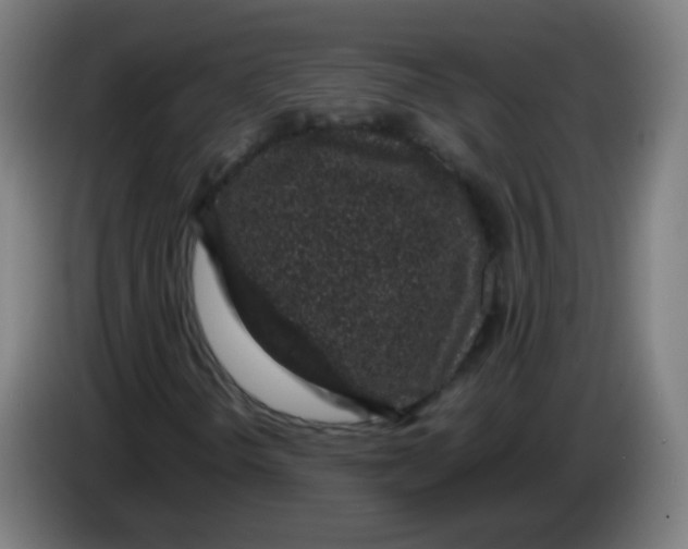 X0000086241298200704261908