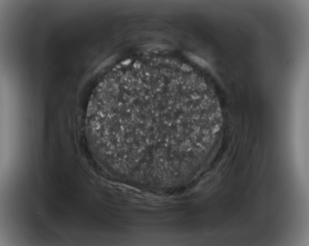 X0000086241399200704261907