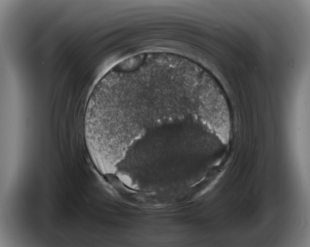 X0000086241529200704261906