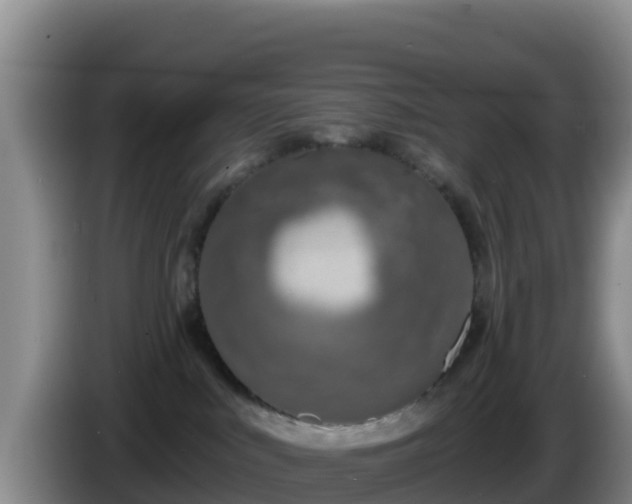 X0000086250043200704051250
