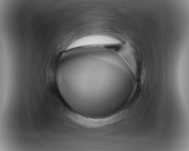 X0000086250039200704122000