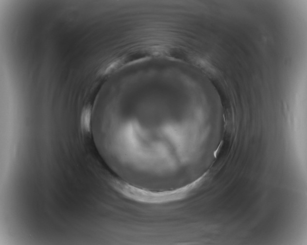 X0000086250047200704122000