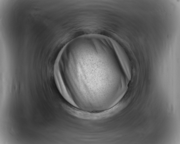 X0000086250048200704122000
