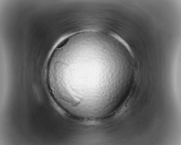 X0000086251099200704121947