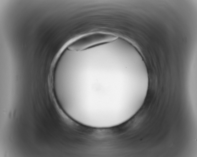X0000086251531200704121942