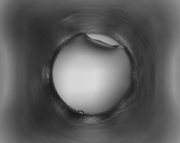 X0000086250115200704191851