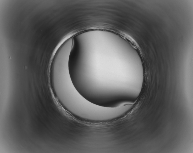 X0000086251138200704191837