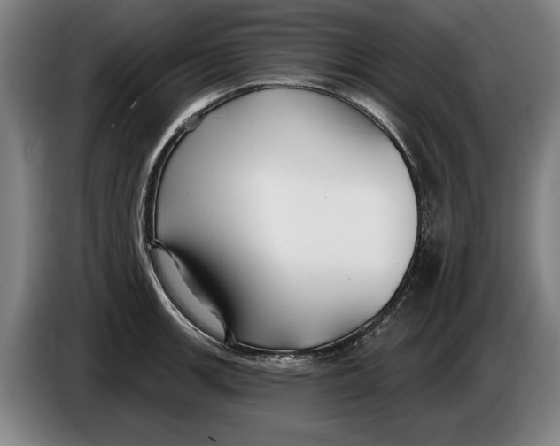 X0000086251139200704191837