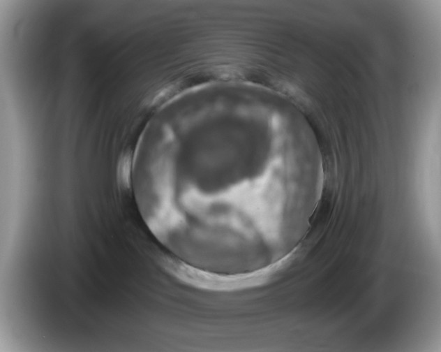 X0000086250047200704261944