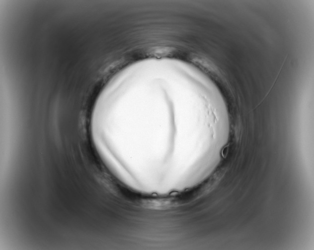 X0000086250366200704261940