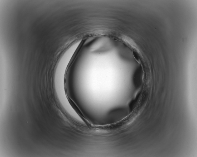 X0000086250585200704261937
