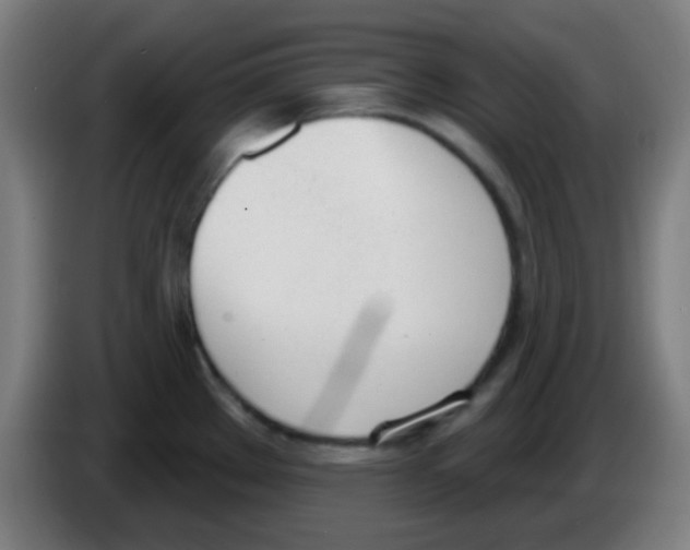 X0000086251289200704261928