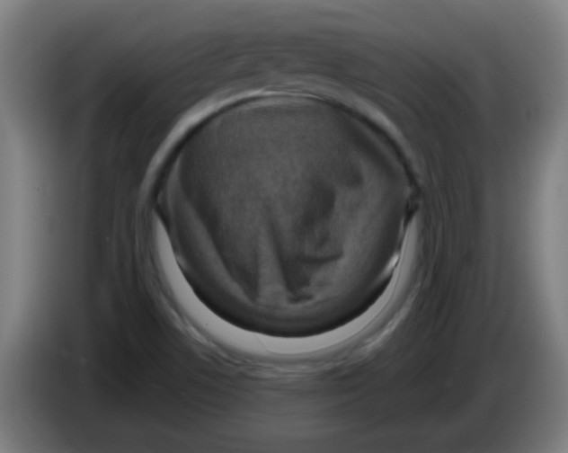 X0000086251506200704261925
